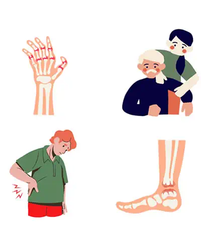 Los síntomas de la artrosis pueden variar de una persona a otra, pero algunos de los más comunes incluyen:
Dolor articular, que empeora con la actividad.
Rigidez matutina que disminuye con el movimiento.
Pérdida de flexibilidad en la articulación afectada.
Inflamación alrededor de la articulación.
Crujidos o chasquidos al mover la articulación.