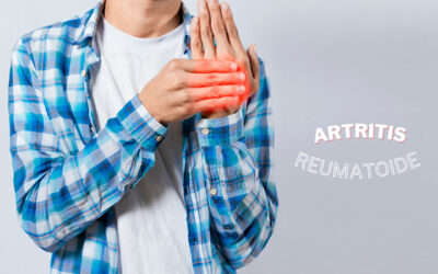 Artritis Reumatoide