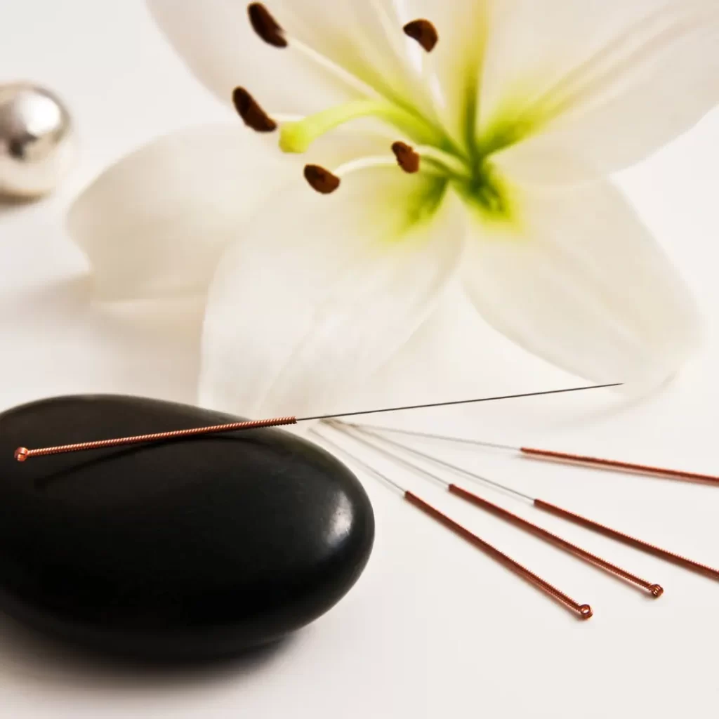 Tratamiento Acupuntural
